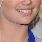 Guess The Celebrity Mustache on adultfans.net